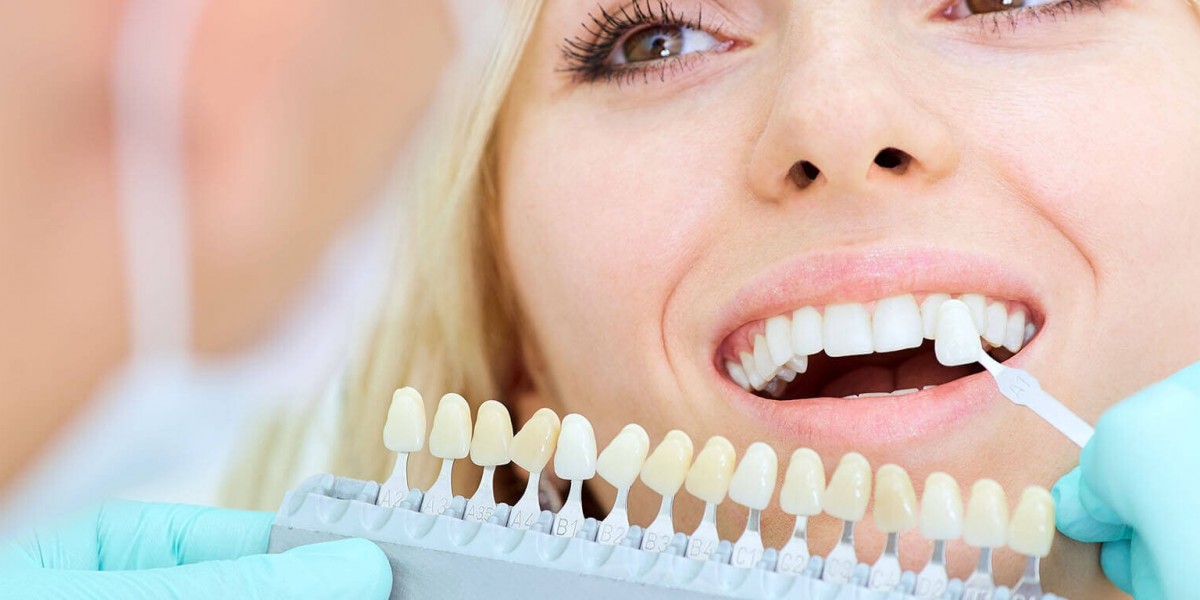 Is Professional Dental Cleaning Important?