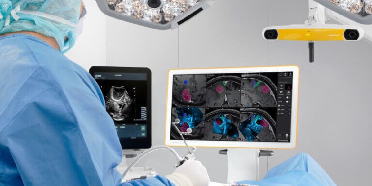 Navigating Growth: An In-Depth Analysis of the Global Intraoperative Imaging Market and its Future Trends