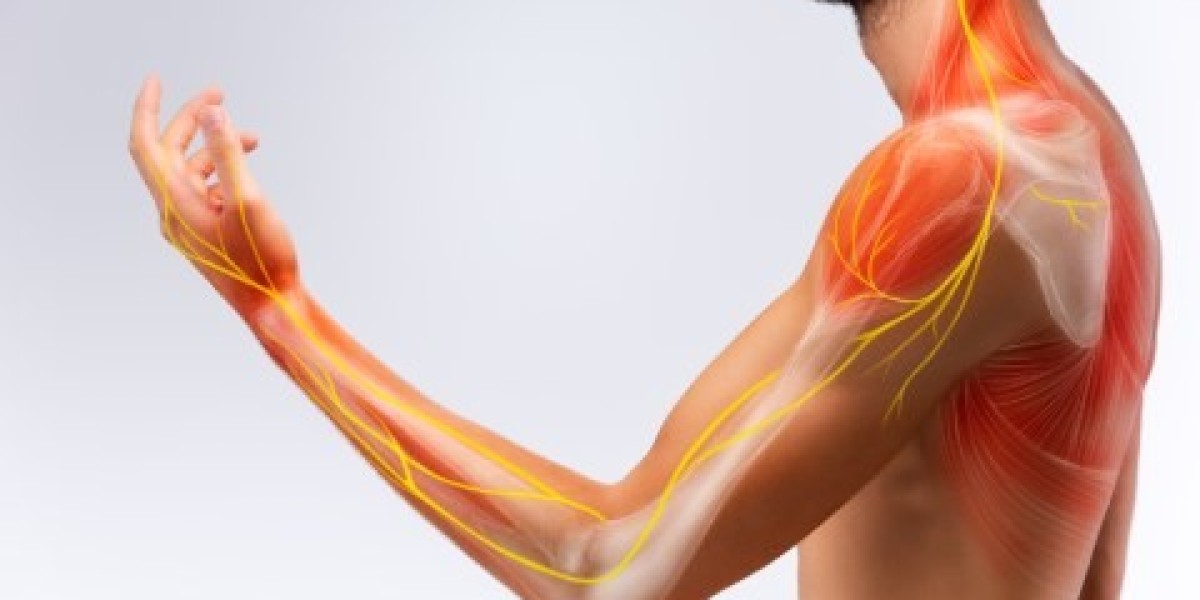 How to get rid of cervical radiculopathy pain