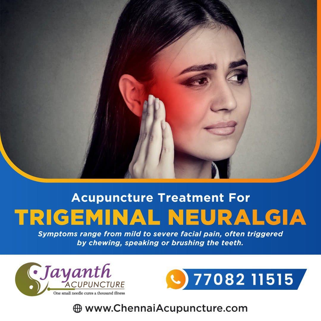 Acupuncture Treatment for Trigeminal Neuralgia Near Me in Chennai