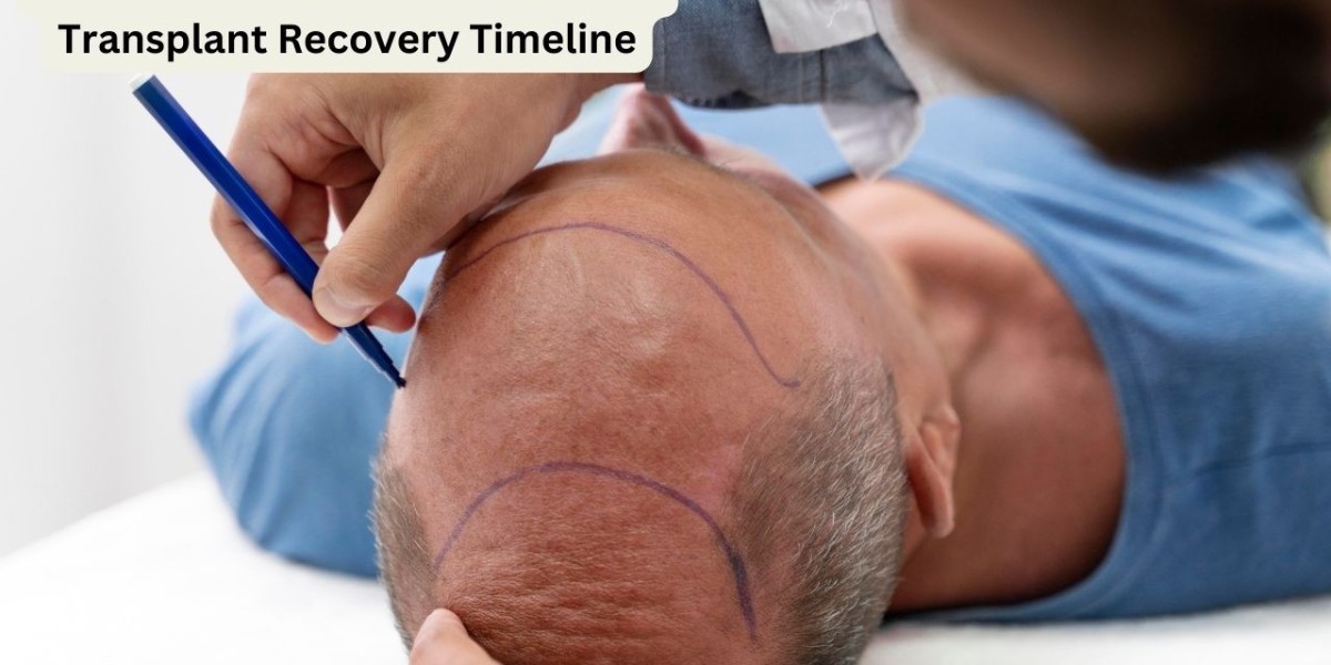 How to Understand the FUT Hair Transplant Recovery Timeline