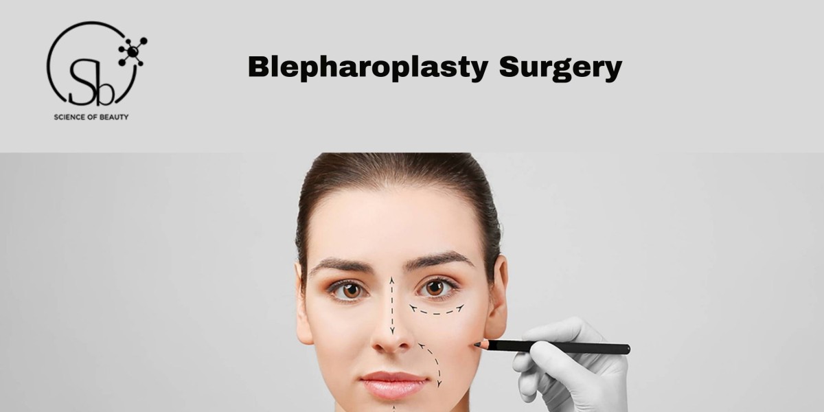 Top Four Reasons to Consider Blepharoplasty Surgery