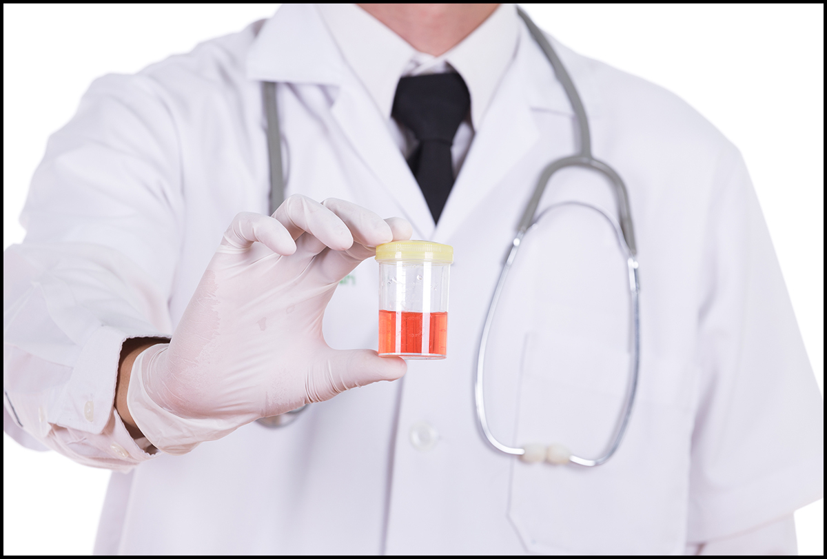 Blood in Urine: Can It Resolve Itself Naturally? | TheAmberPost