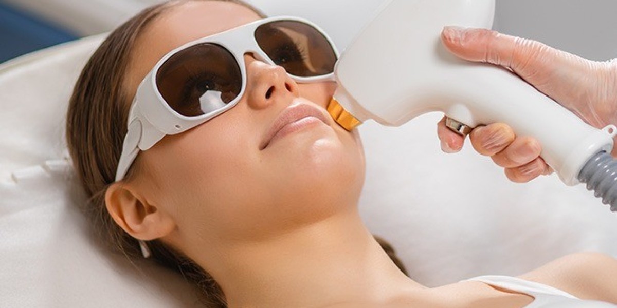 Everything You Need to Know about the Best Laser Hair Removal in Delhi