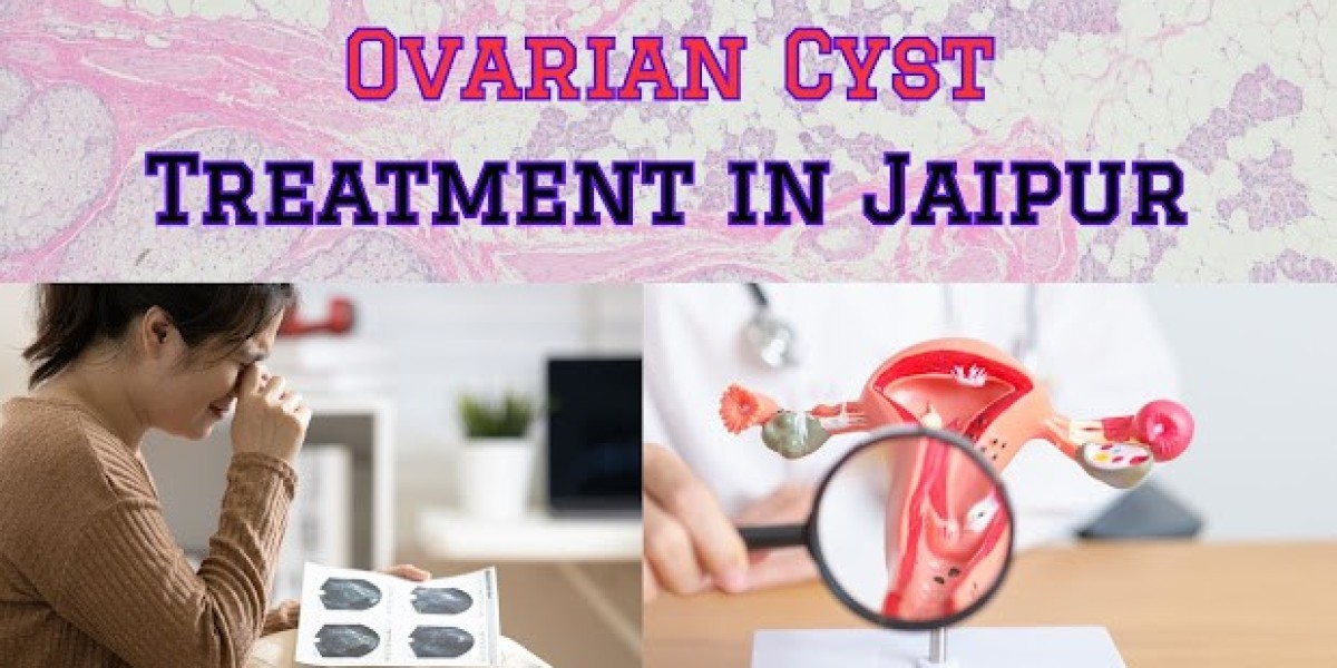 Ovarian Cyst Treatment in Jaipur
