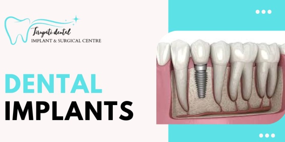 What You Need to Know About Dental Implants