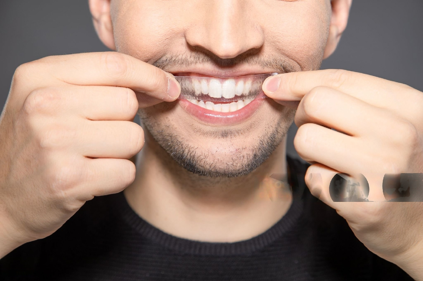 Whiten Your Way to Success: Crest 3D Whitestrips