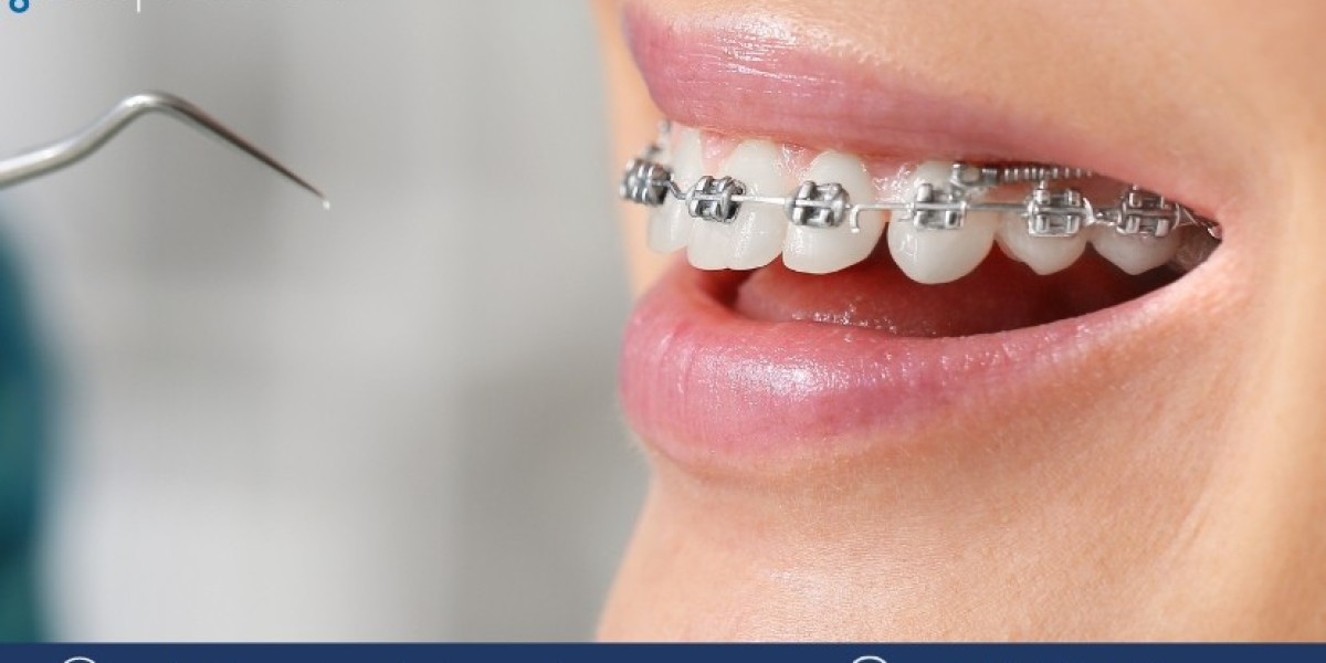 Orthodontic Consumables Market Size, Share, Trends, Growth Report 2024-2032