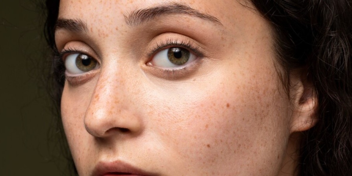 Unlocking Radiant Skin: Anua Dark Spot Correcting Serum Review