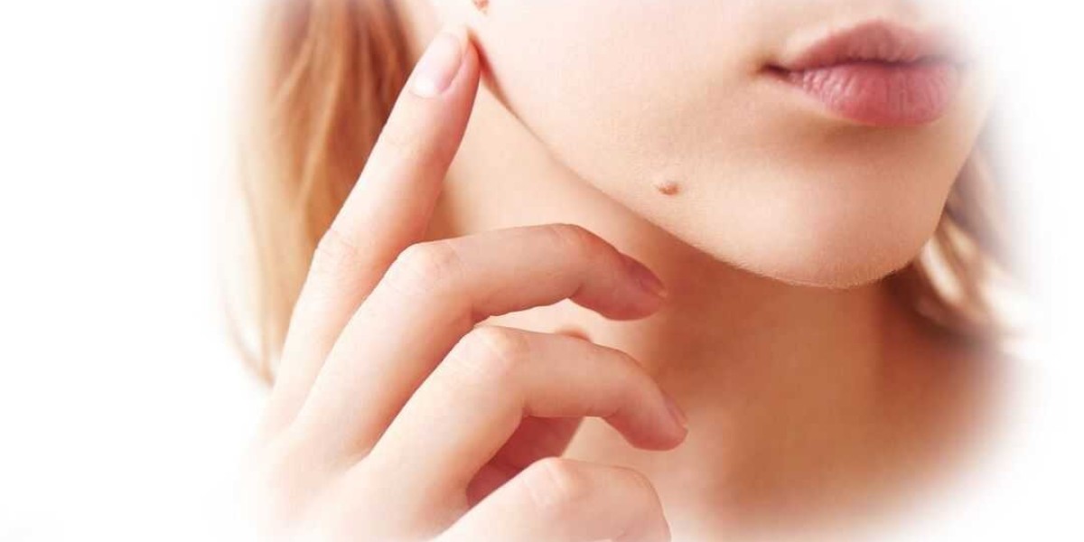SkinFix Skin Tag Remover USA Price - How Does It Work Or Hoax?