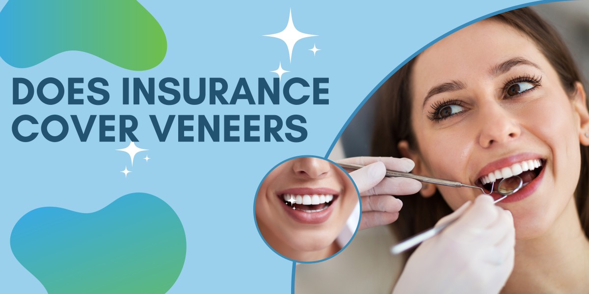 Does Insurance Cover Veneers