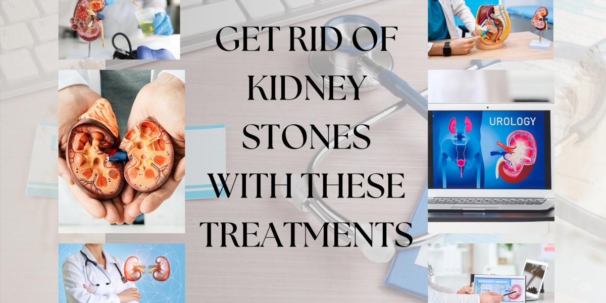 GET RID OF KIDNEY STONES WITH THESE TREATMENTS
