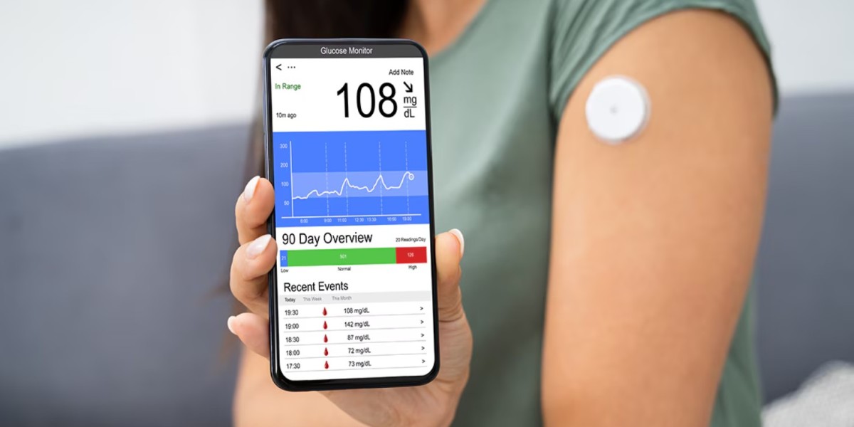 Global Continuous Glucose Monitoring (CGM) Technology Market Size/Share Worth US$ 20580 million by 2030 at a 15.80% CAGR
