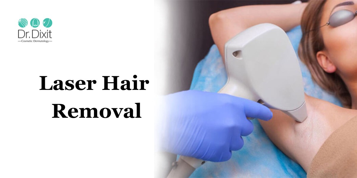 How to Prepare for Your Laser Hair Removal Session?