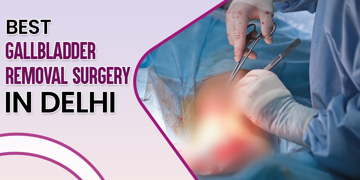 Best Gallbladder Removal Surgery in Delhi, India