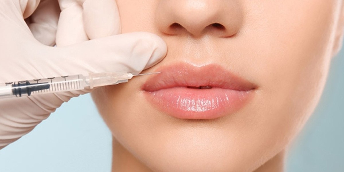 Affordable Dermal Fillers Cost in Richmond | Bio-International Laser Clinic