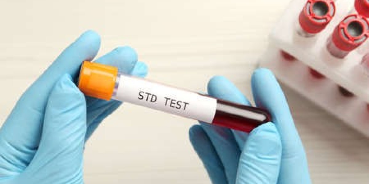 Exploring STD Testing in Manchester