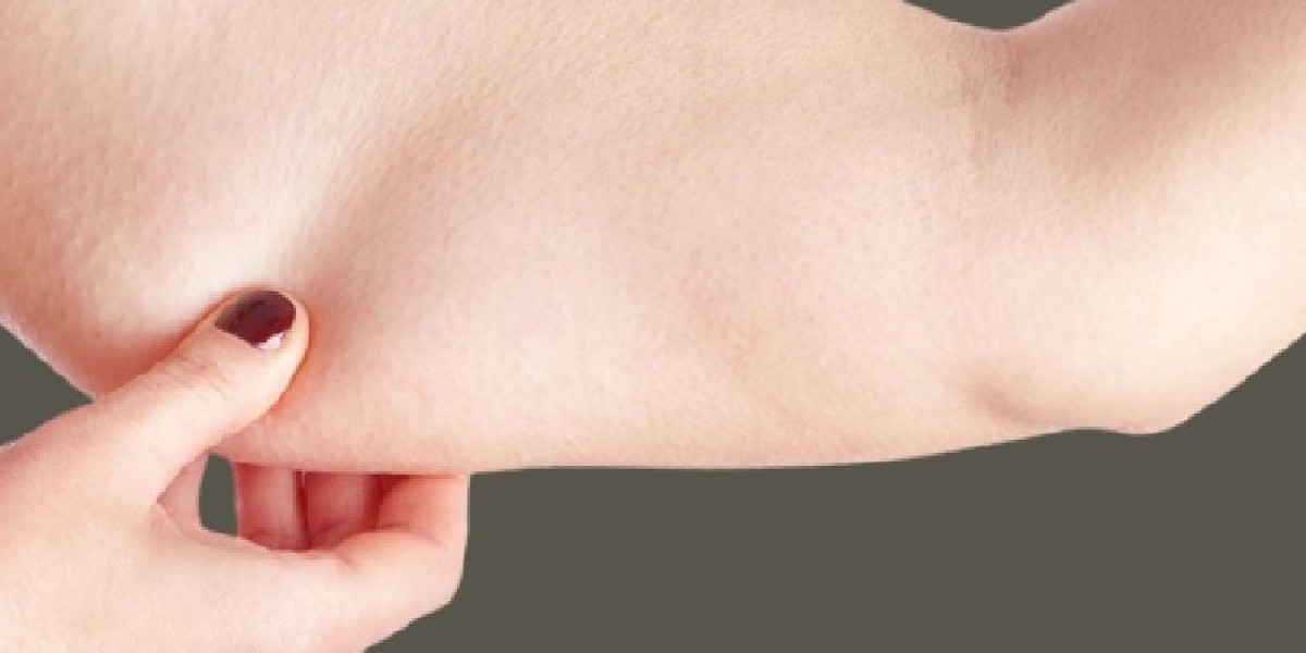 How to Get Rid of Flabby Arms?