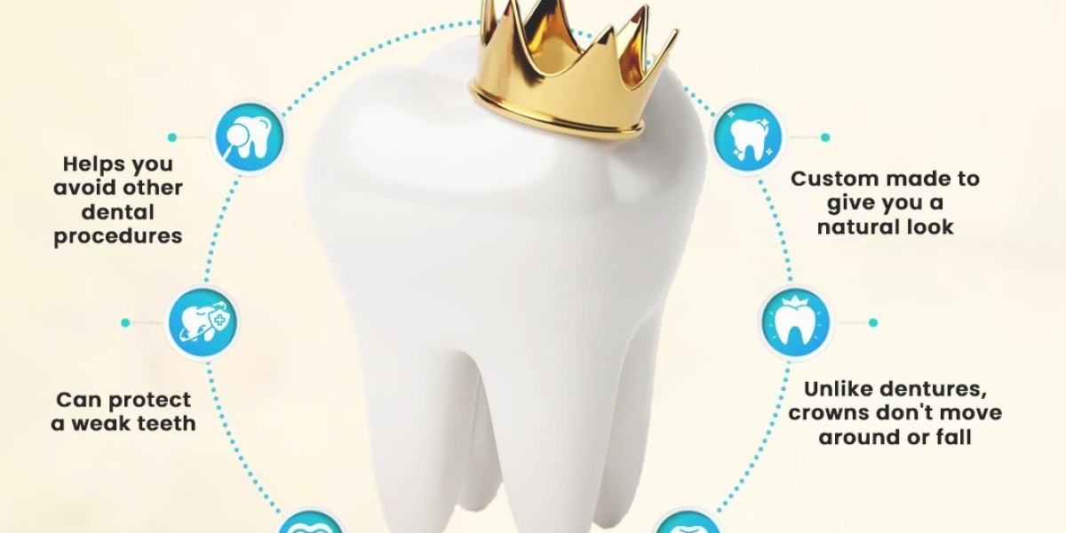 Find Best Dental Crowns Treatment In Noida