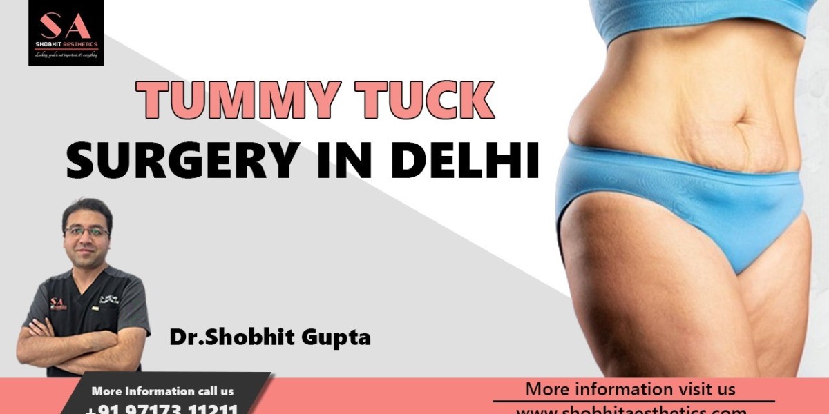 Cost of Tummy Tuck Surgery in Delhi: Navigating Expenses