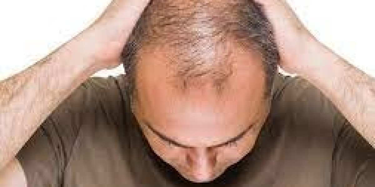 Maximize Results from Platelet-Rich Plasma (PRP) Injections & Hair Transplant