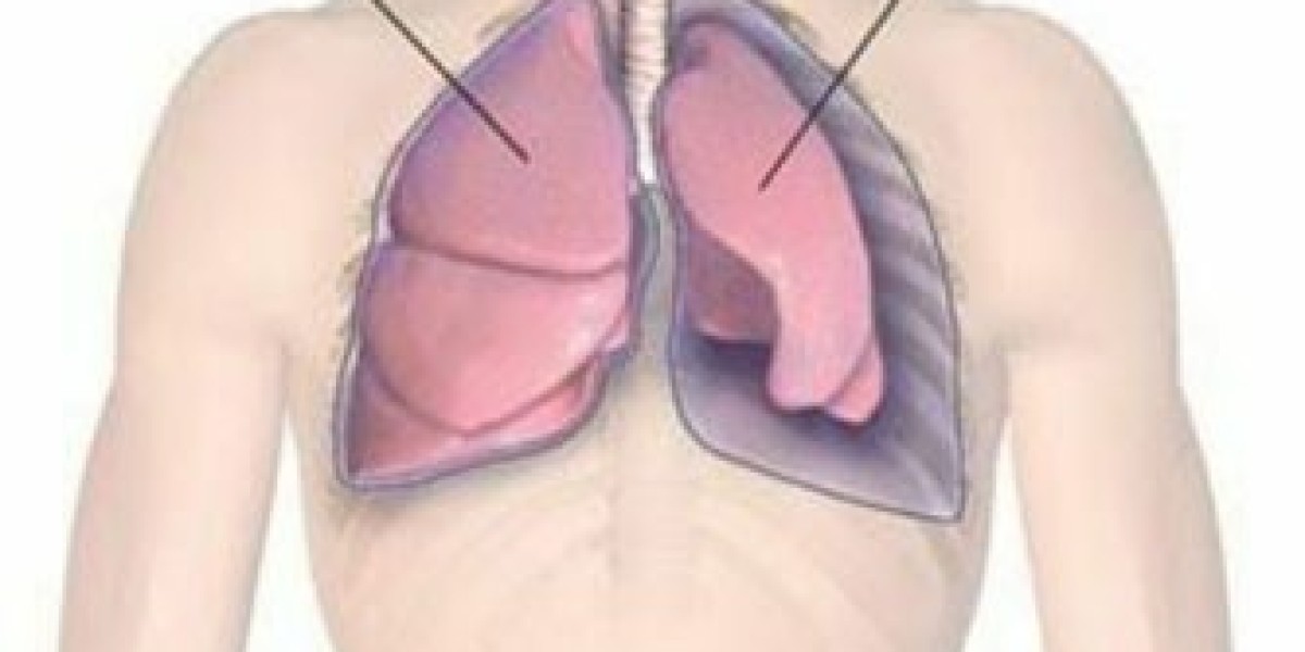 Comprehensive Guide to Lung Cancer Treatment