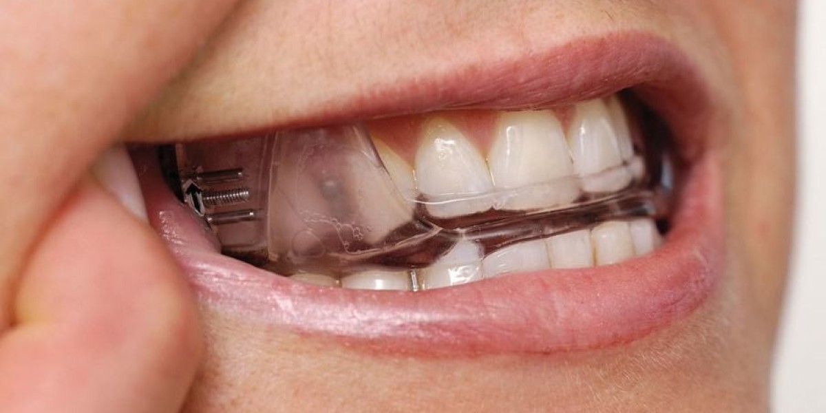 Dental Devices in Riyadh: Transforming Your Oral Health Experience