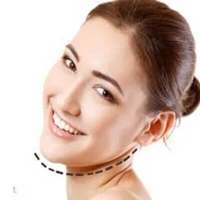 Double Chin Removal in Dubai & Abu Dhabi | Non-Surgical Removal Cost