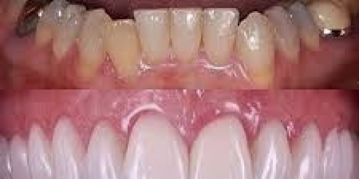 Tratamientos Estéticos Dentales: Mejora Tu Sonrisa con las Últimas Innovaciones
