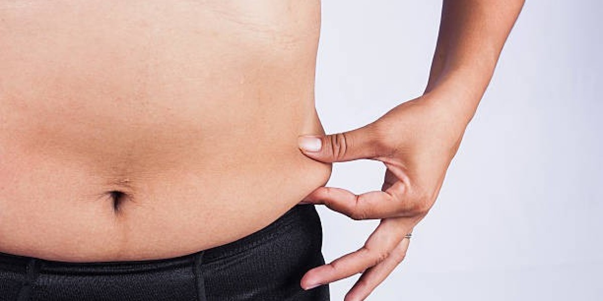 Tummy Tuck in Riyadh: Understanding the Procedure, Recovery, and Results