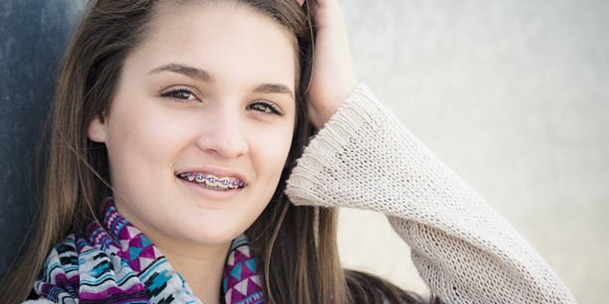 Top Benefits of Metal Braces in Riyadh for Teens and Adults