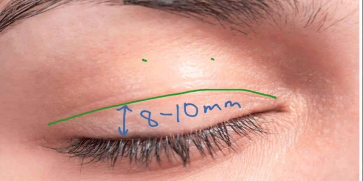 Achieve Perfect Results with the Best Eyelid Surgery Doctor in Riyadh