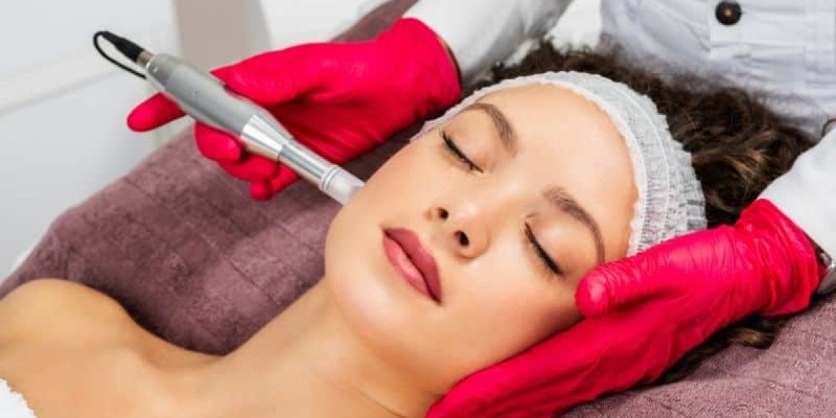 Experience Rejuvenated Skin with Microneedling Southampton at Eliza Facalist