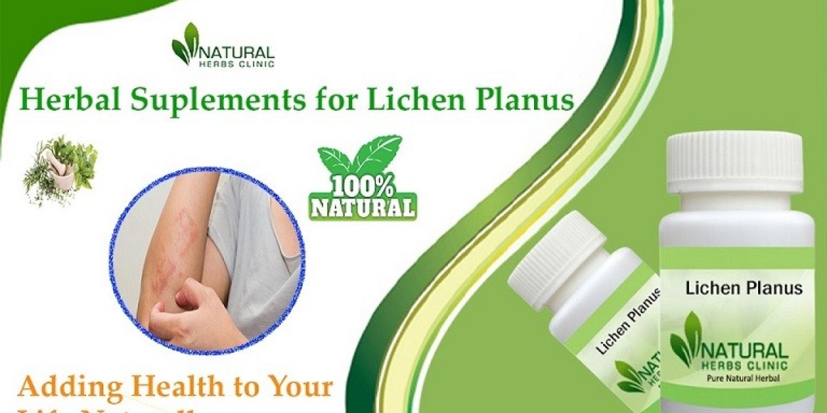 Lichen Planus Treatment at Home: Safe and Natural Remedies That Work!