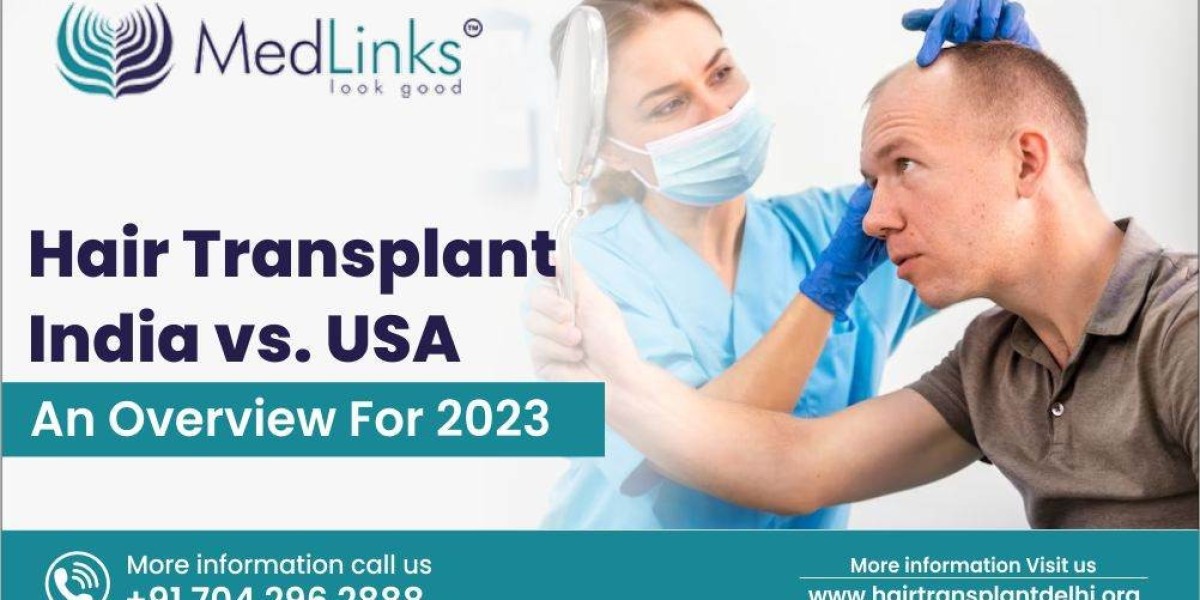 Hair Transplant in India vs. USA: A Detailed Cost and Quality Comparison