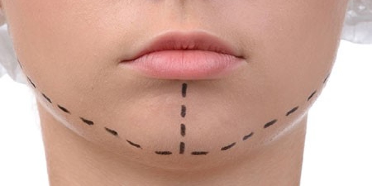 Get the Jawline You Desire: Jaw Contouring in Riyadh