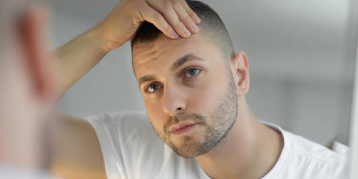 Hair Loss Treatments: A Complete Guide to Options and Effectiveness