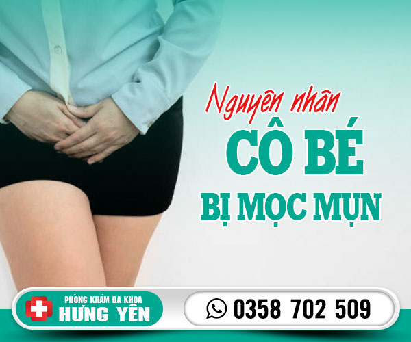 Bị mọc mụn ở cô bé có sao không? Chữa như nào?