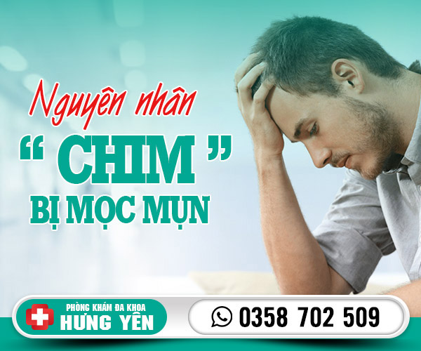 Bị mọc mụn ở chim có nguy hiểm không?