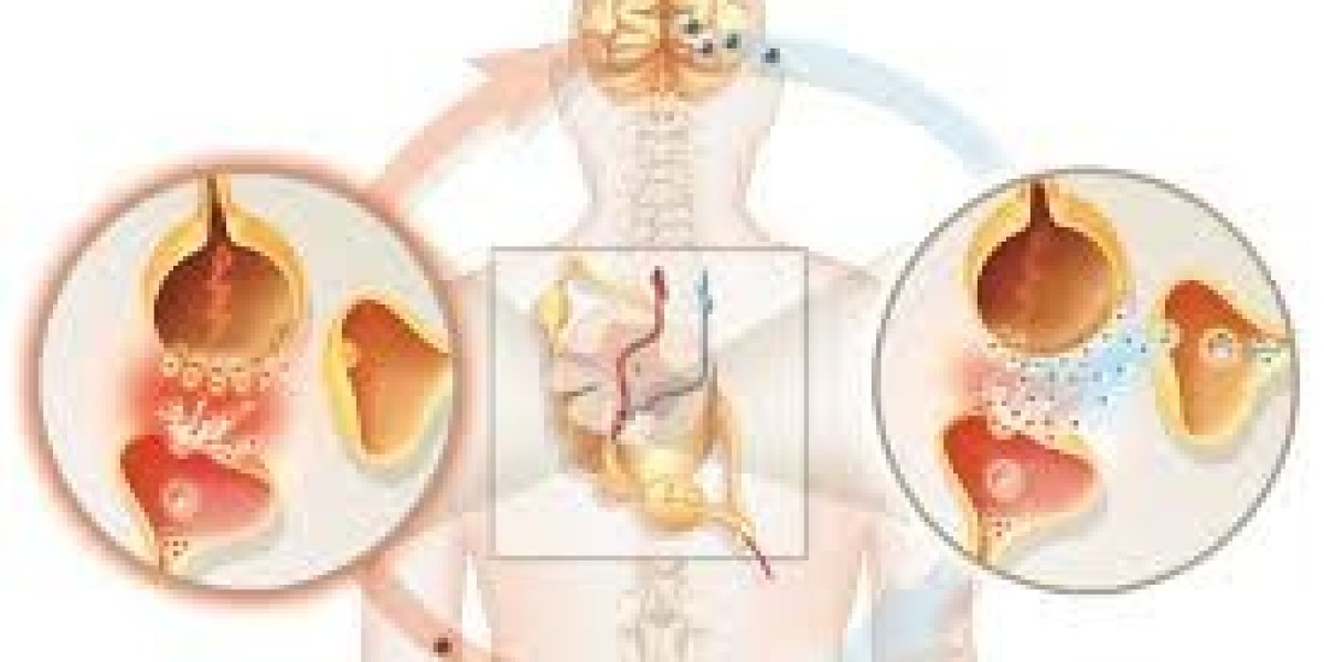 Gabapentin's Potential: 100mg and 400mg Revealed – Which One Holds the Key?