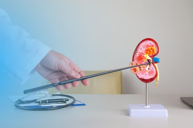 Understanding Kidney Stones and Finding the Right Doctor in Kuwait