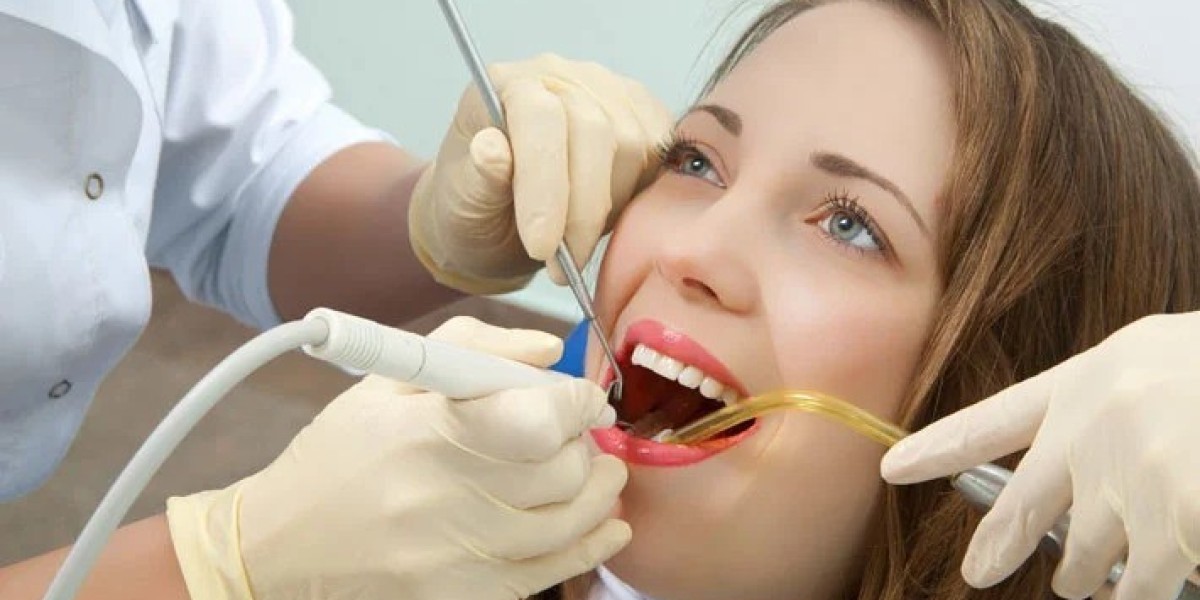 Freshen Up Your Smile with Professional Teeth Scaling