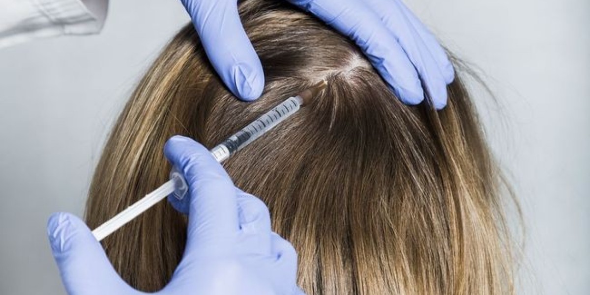 Is GFC Hair Therapy a Better Option Than Hair Transplant in Dubai?