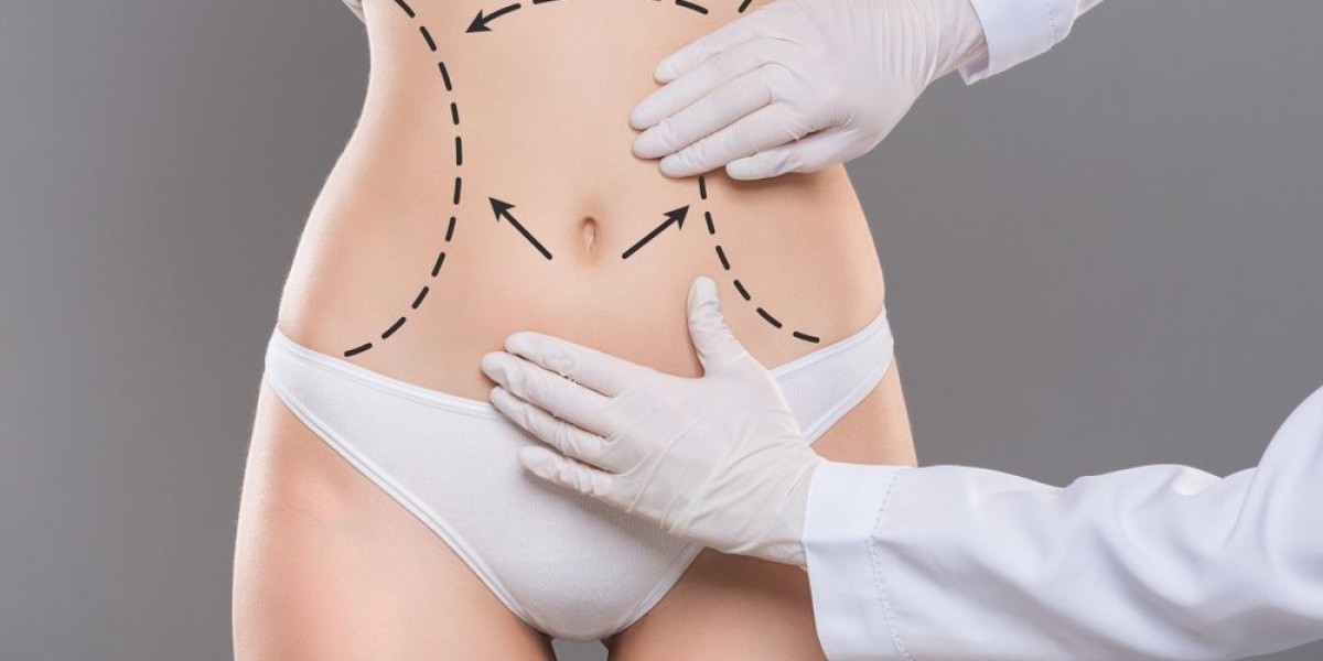 Can liposuction go wrong?