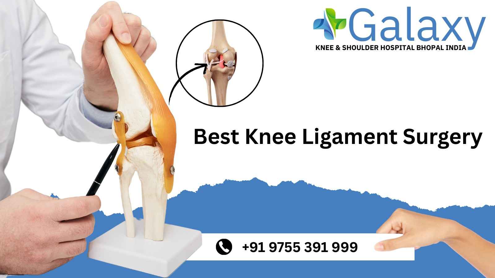 Best Knee Ligament Surgery in Bhopal ☎ +91-9755391999
