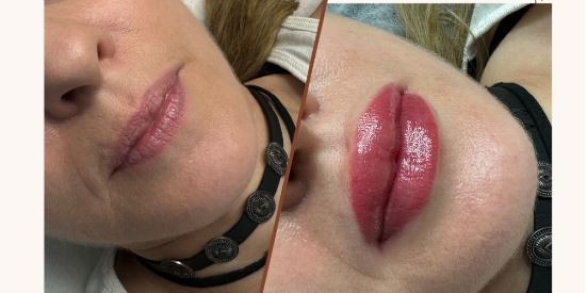 7 Non-Clinical Beauty Treatments Taking Over Salons in 2025