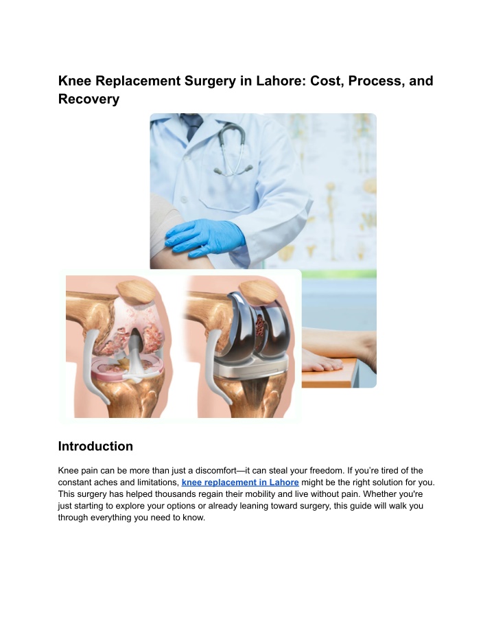 PPT - Knee Replacement Surgery in Lahore_ Cost, Process, and Recovery PowerPoint Presentation - ID:14293831