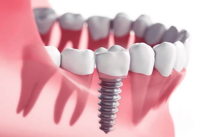Advanced Orthodontic Care at Symphony Smiles Dental | by Symphonysmiles | Jun, 2025 | Medium