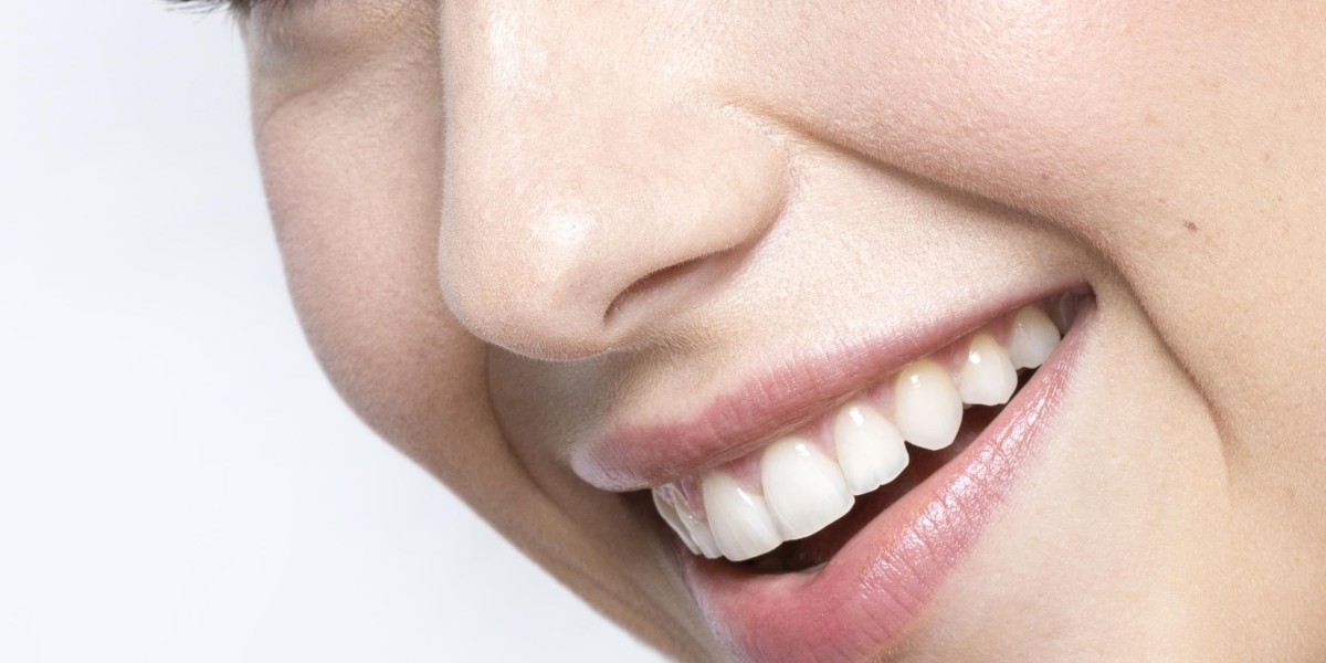 Best Teeth Whitening in Toronto | Discover Your Brightest Smile at Dentistry in the Beach