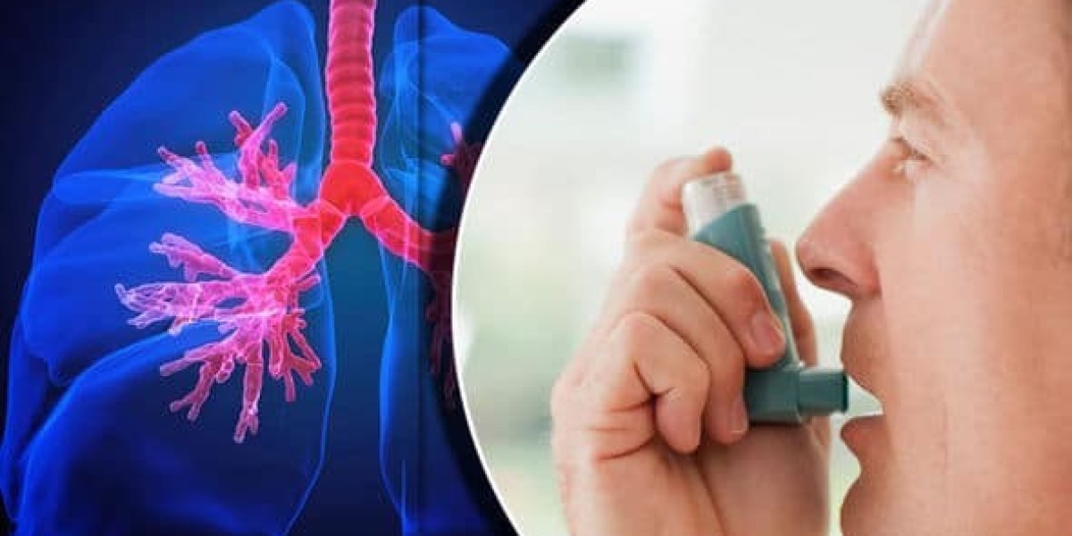 Asthma Doctor in Varanasi: Best Specialist for Allergy & Breathing Problems